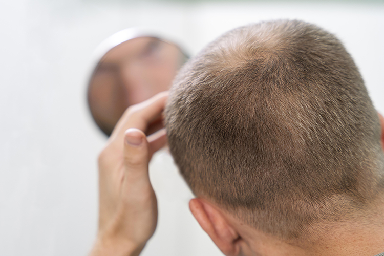 Hair Replacement Wigs