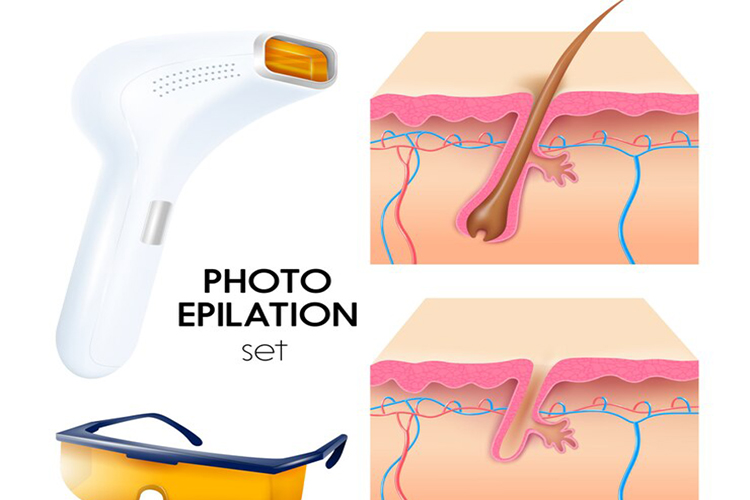 FUE Hair Transplant